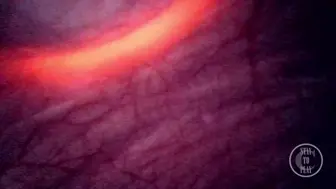 Look inside my Bladder as I push a Torch up my Booty Teaser